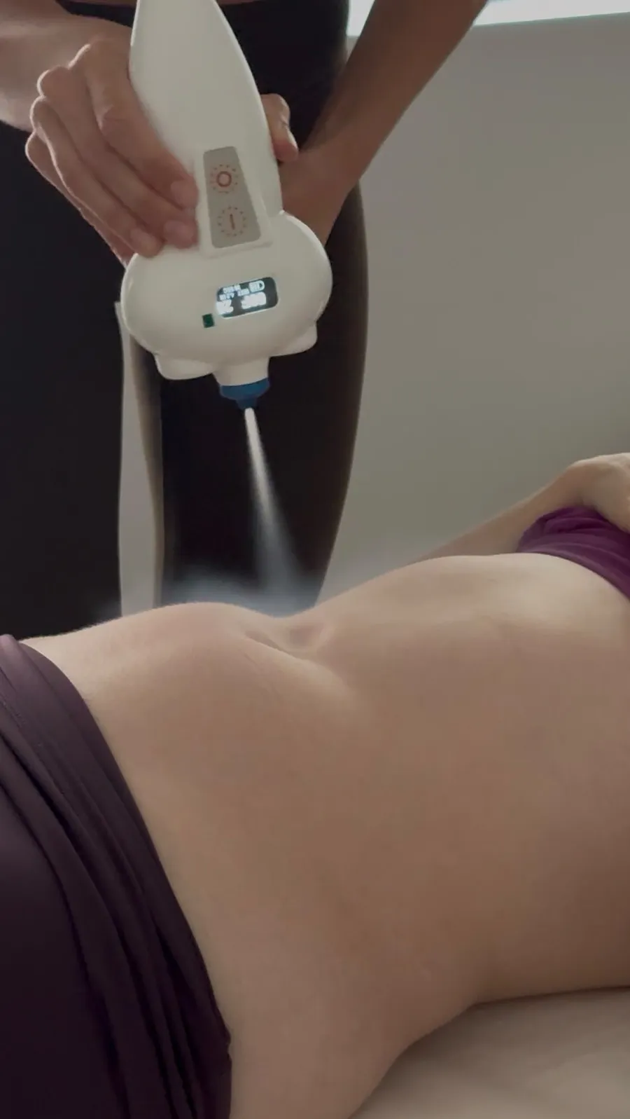 REVIKA therapist performing localized cryotherapy on a client's thigh in Newport Beach